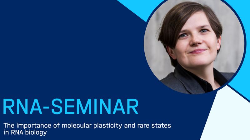 RNA-Seminar: Dina Grohmann